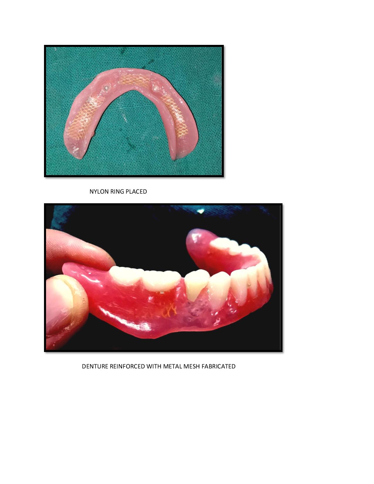 case report for the department of prosthodontics in the section of health informatics